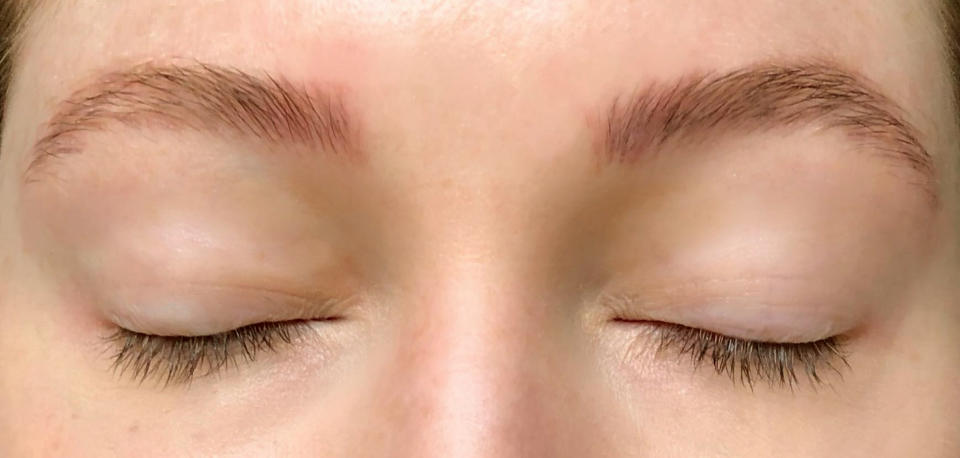قبل استخدام Grandelash أو Grandebrow Serum.
