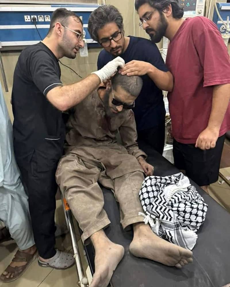 يتلقى الشخص علاجًا للإصابات التي أصيبت بها خلال هجوم صاروخي هندي مشتبه به في مستشفى في باهاوالبور ، في أعقاب ضربات صاروخية من قبل الهند في مدن في باكستان ، كما ذكرت العلاقات العامة للجيش الباكستاني. حسين علي/زوما سلك الصحافة/DPA