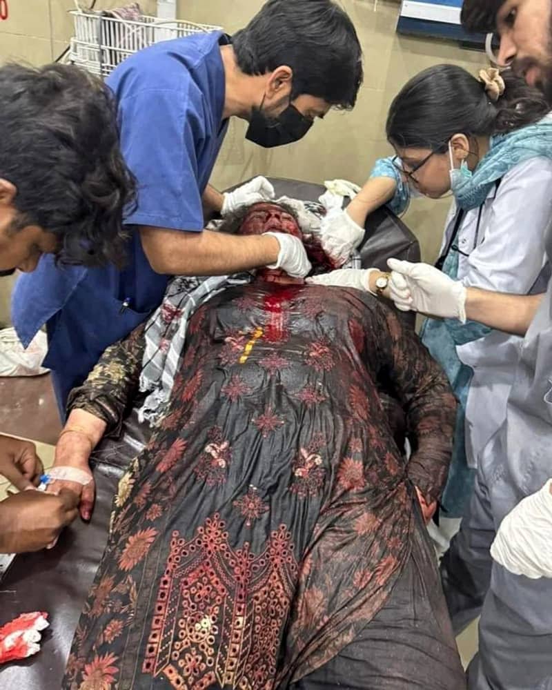 يتلقى الشخص علاجًا للإصابات التي أصيبت بها خلال هجوم صاروخي هندي مشتبه به في مستشفى في باهاوالبور ، في أعقاب ضربات صاروخية من قبل الهند في مدن في باكستان ، كما ذكرت العلاقات العامة للجيش الباكستاني. حسين علي/زوما سلك الصحافة/DPA