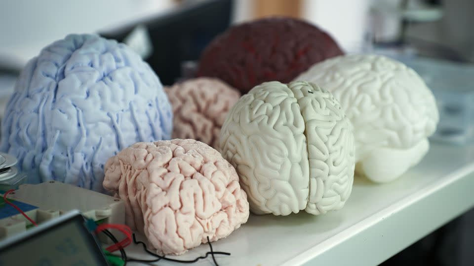 نماذج الدماغ المعروضة داخل مختبر CIBR في بكين ، الصين في 28 مايو 2025. - CNN