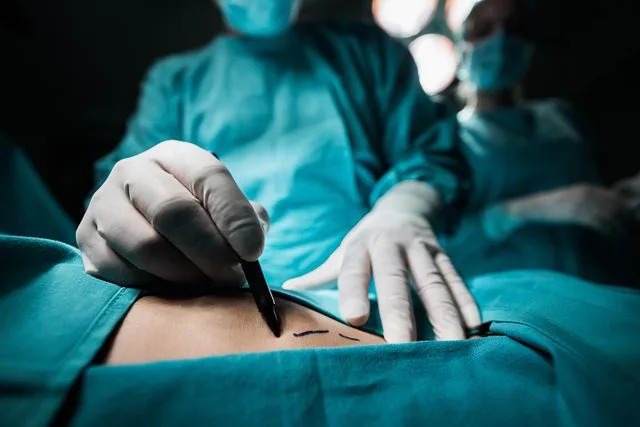 Getty ألبوم صورة لجراح تجميل