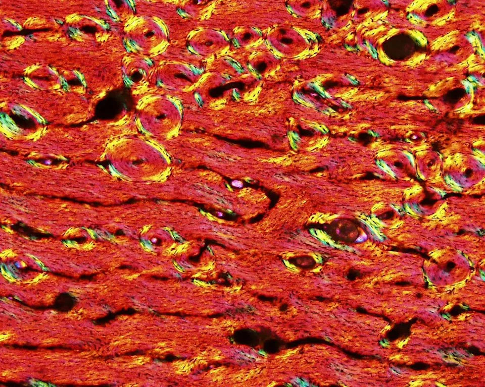 صورة مجهرية تظهر المساحات المتموجة الأفقية والمساحات الدائرية على خلفية صلبة.