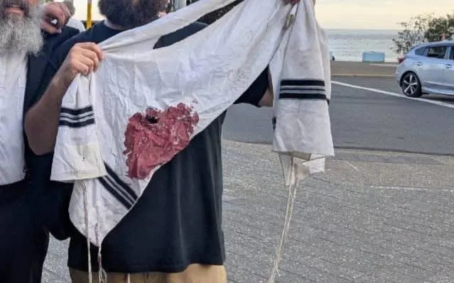 طليت مملوء بالدماء باللونين الأزرق والأبيض